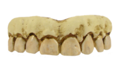 Billy Bob Skeleton Gebit